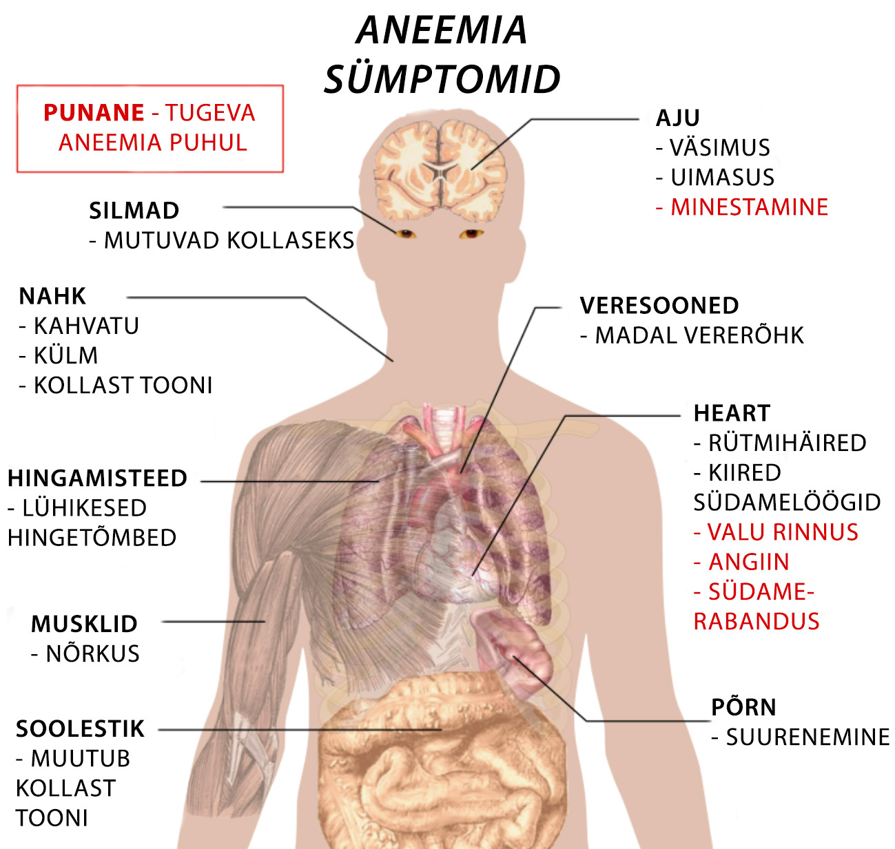 aneemia