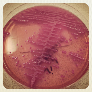 E.coli-bakter