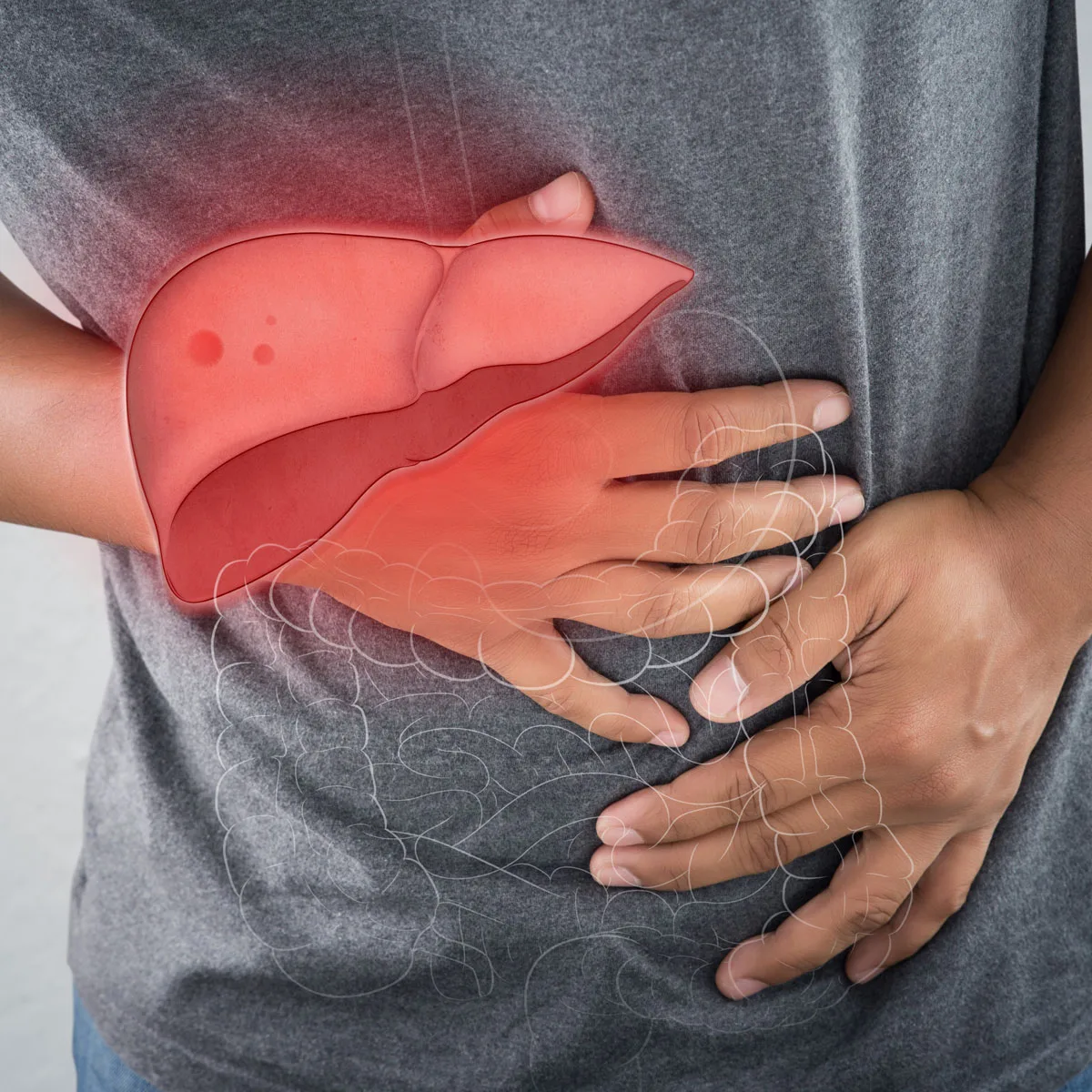 Read more about the article Hepatiit e. maksapõletik