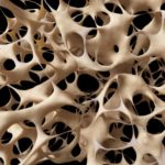 OSTEOPOROOS – sümptomid, põhjused, riskigrupid, ennetus ja ravi