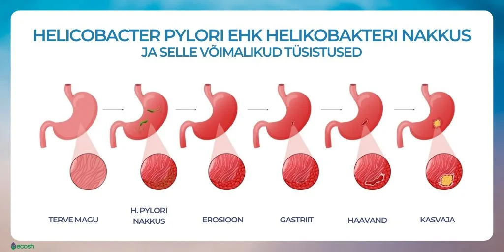 ECOSH-Helicobacter_pylori_nakkus_ehk_helikobakteri_nakkus